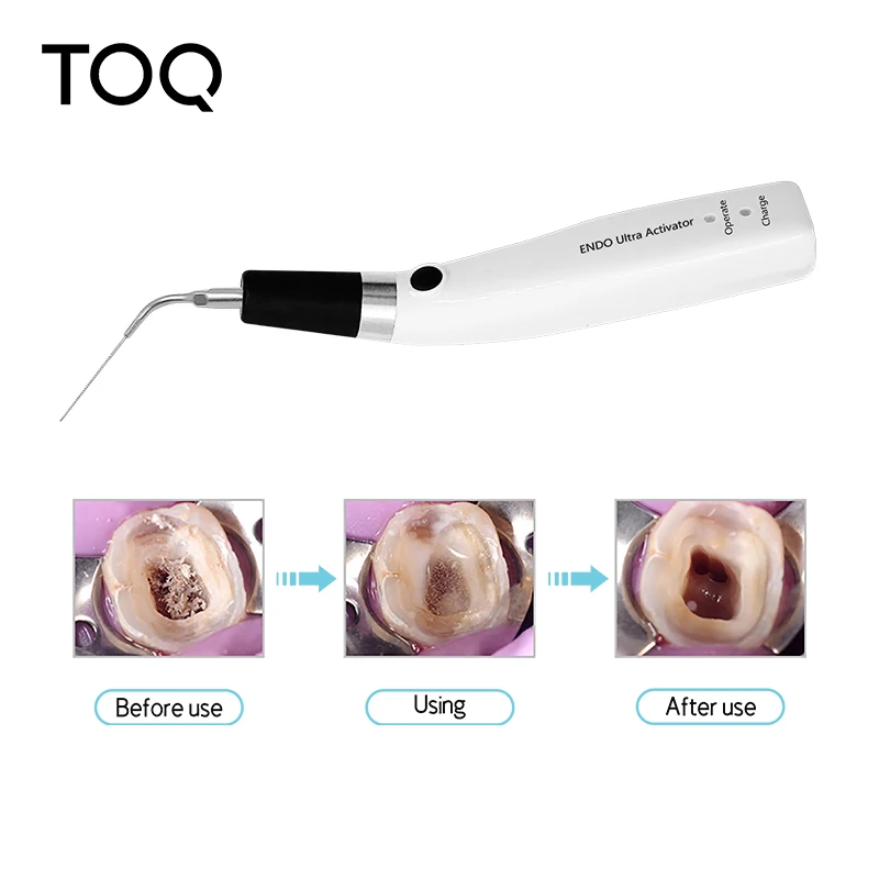 Teeth Whitening Shade Guide - Dental Endo Ultra Activator Endo Irrigator