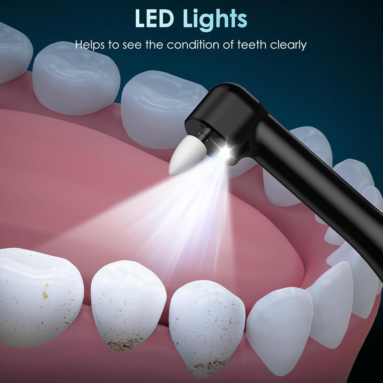 Tooth Polisher Rechargeable Te - Teeth Whitening Or Tooth Whitening ulasan dan harga