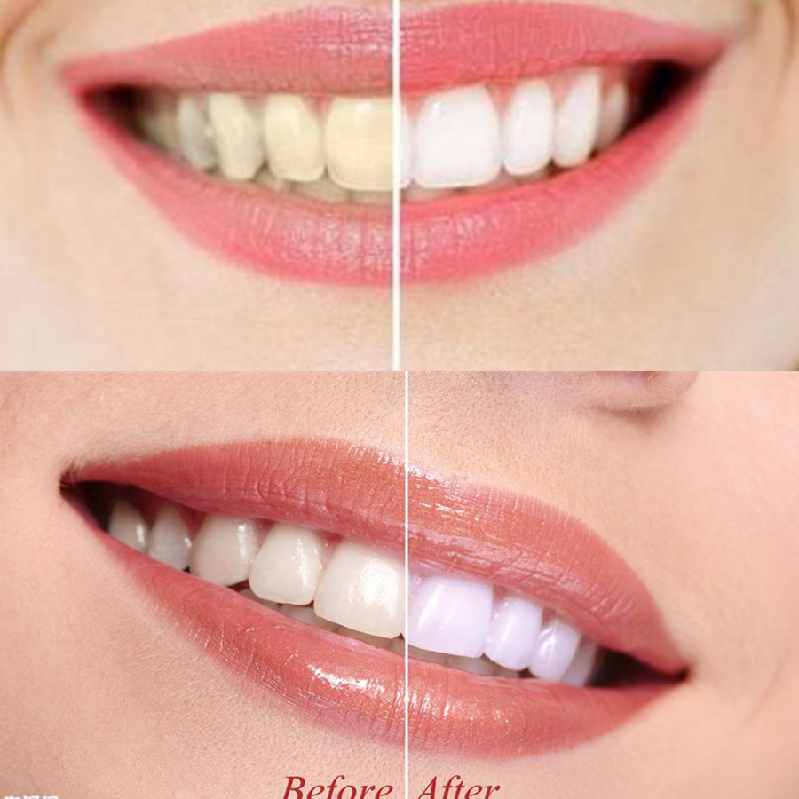 Bamboo Charcoal Teeth Tooth De - Teeth Whitening Charcoal ulasan dan harga