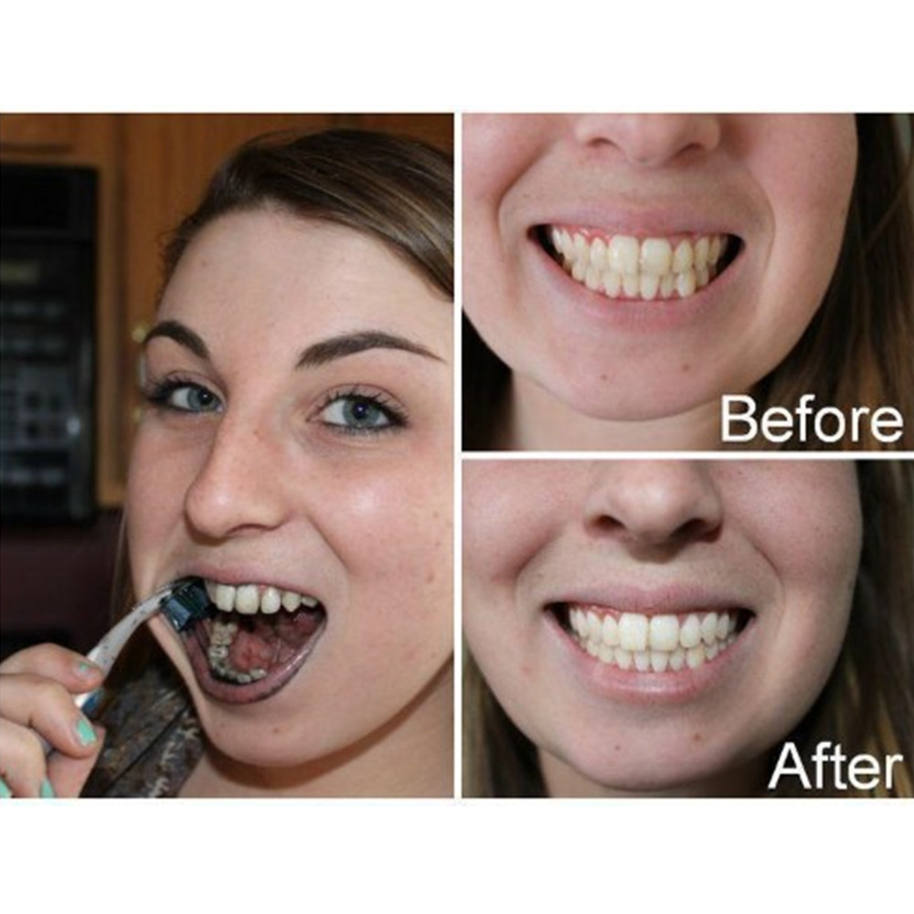 Bamboo Charcoal Teeth Tooth De - Teeth Whitening Charcoal ulasan dan harga
