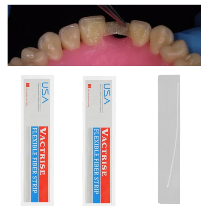 1/5Pcs Glass Splint Loose Toot - Teeth Whitening Laser ulasan dan harga