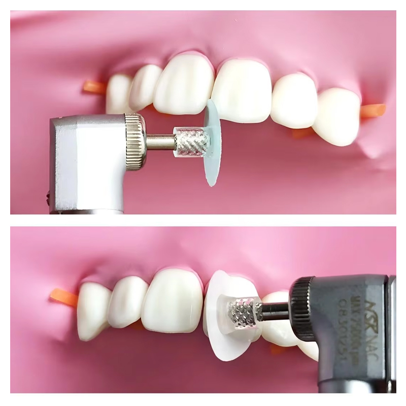 40Pcs Dental Polishing Disc Co - Teeth Whitening Uk ulasan dan harga