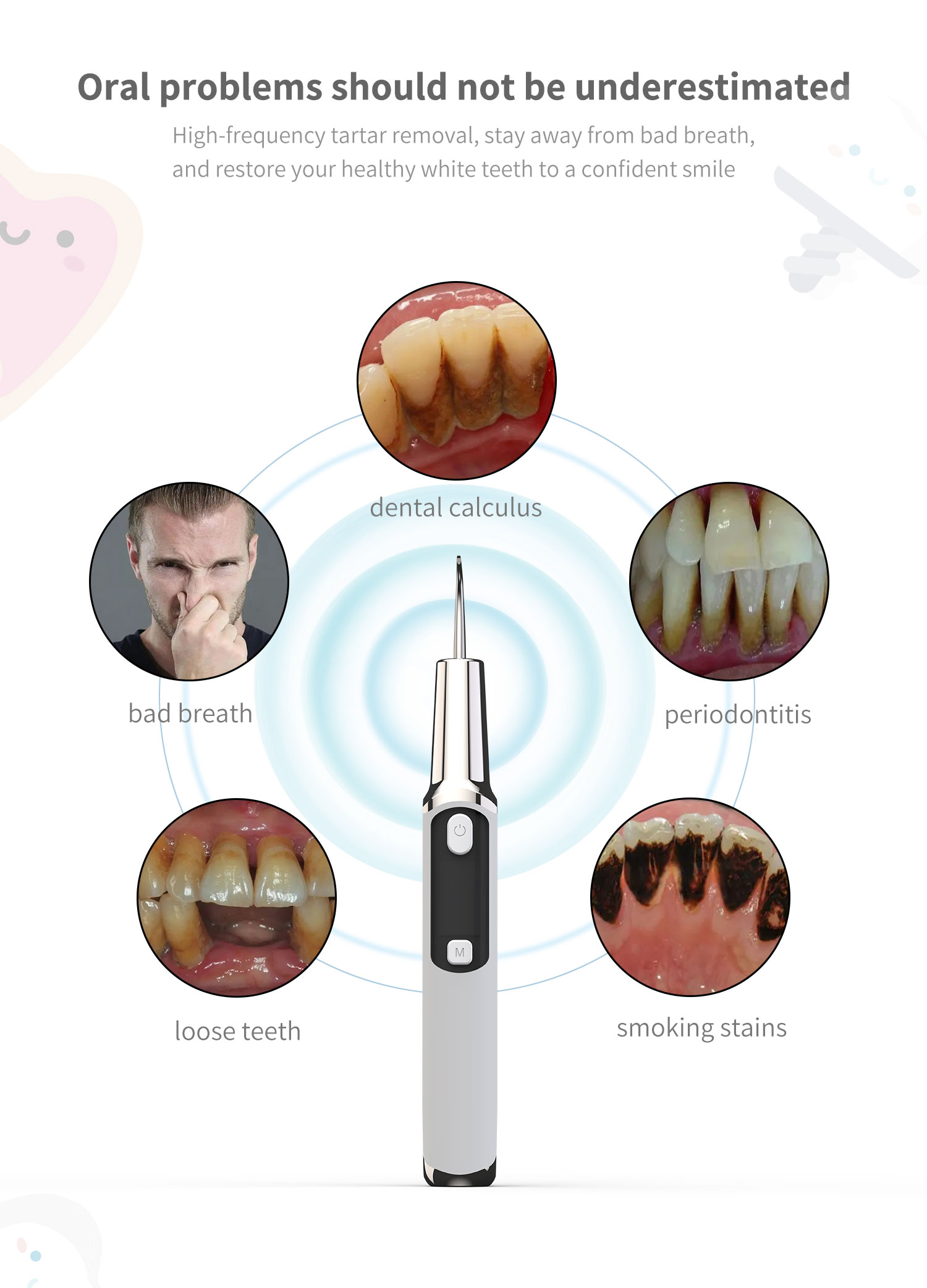 Electric Sonic Dental Calculus - Teeth Whitening Or Tooth Whitening ulasan dan harga