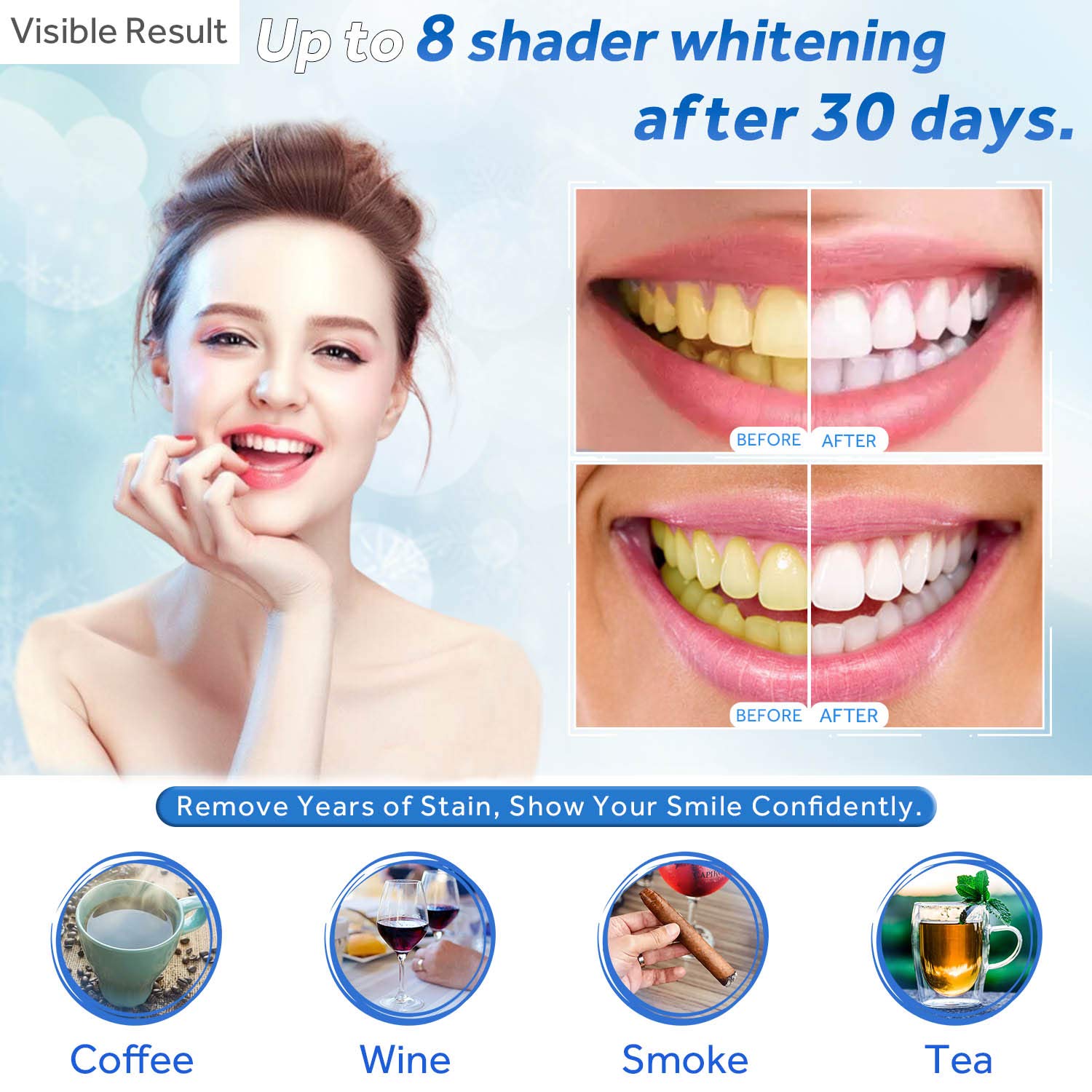 Teeth Whitening Gel Refill Syr - Teeth Whitening Laser ulasan dan harga