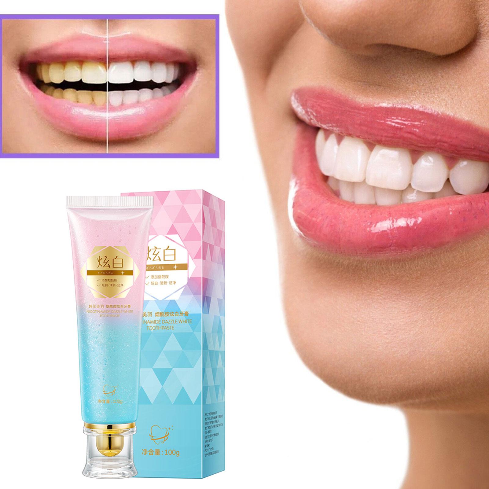 Niacinamide Whitening Toothpas - Teeth Whitening Treatment ulasan dan harga