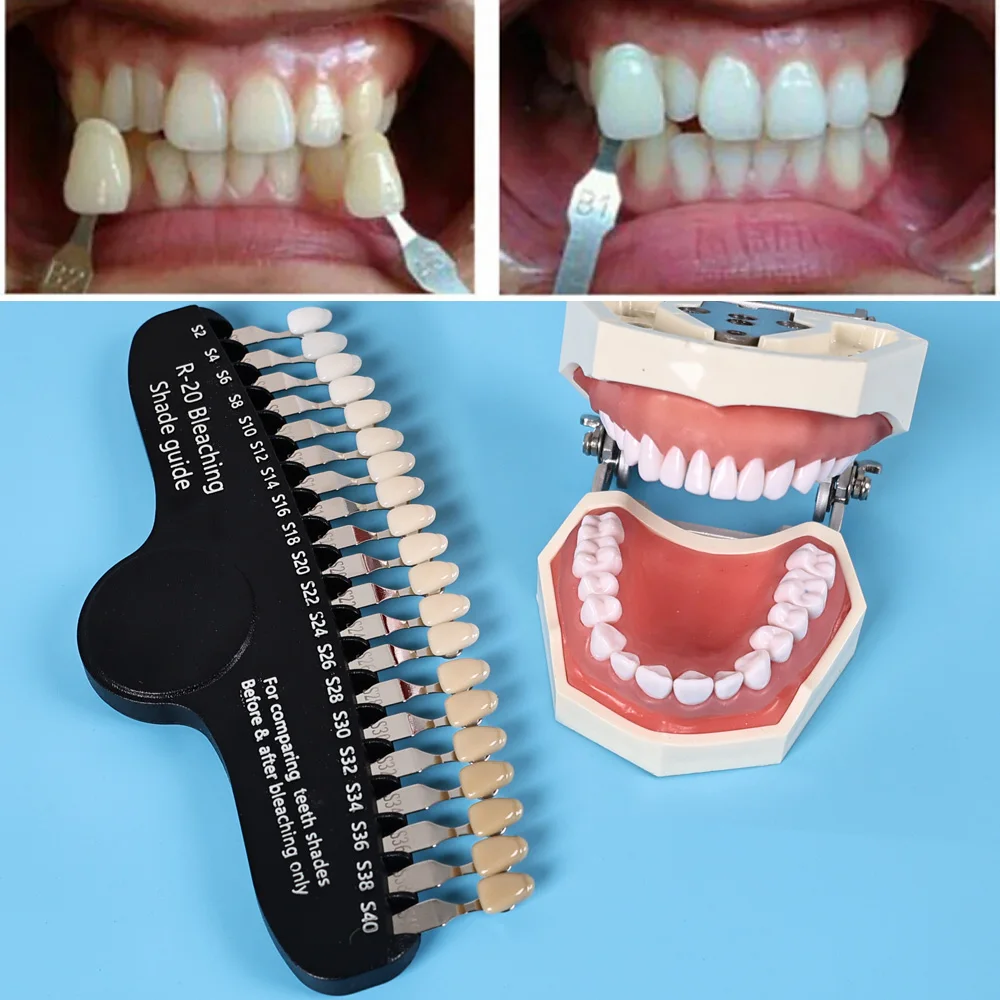 ELIJAH R-20 Bleaching Shade Gu - Teeth Whitening Shade Guide ulasan dan harga