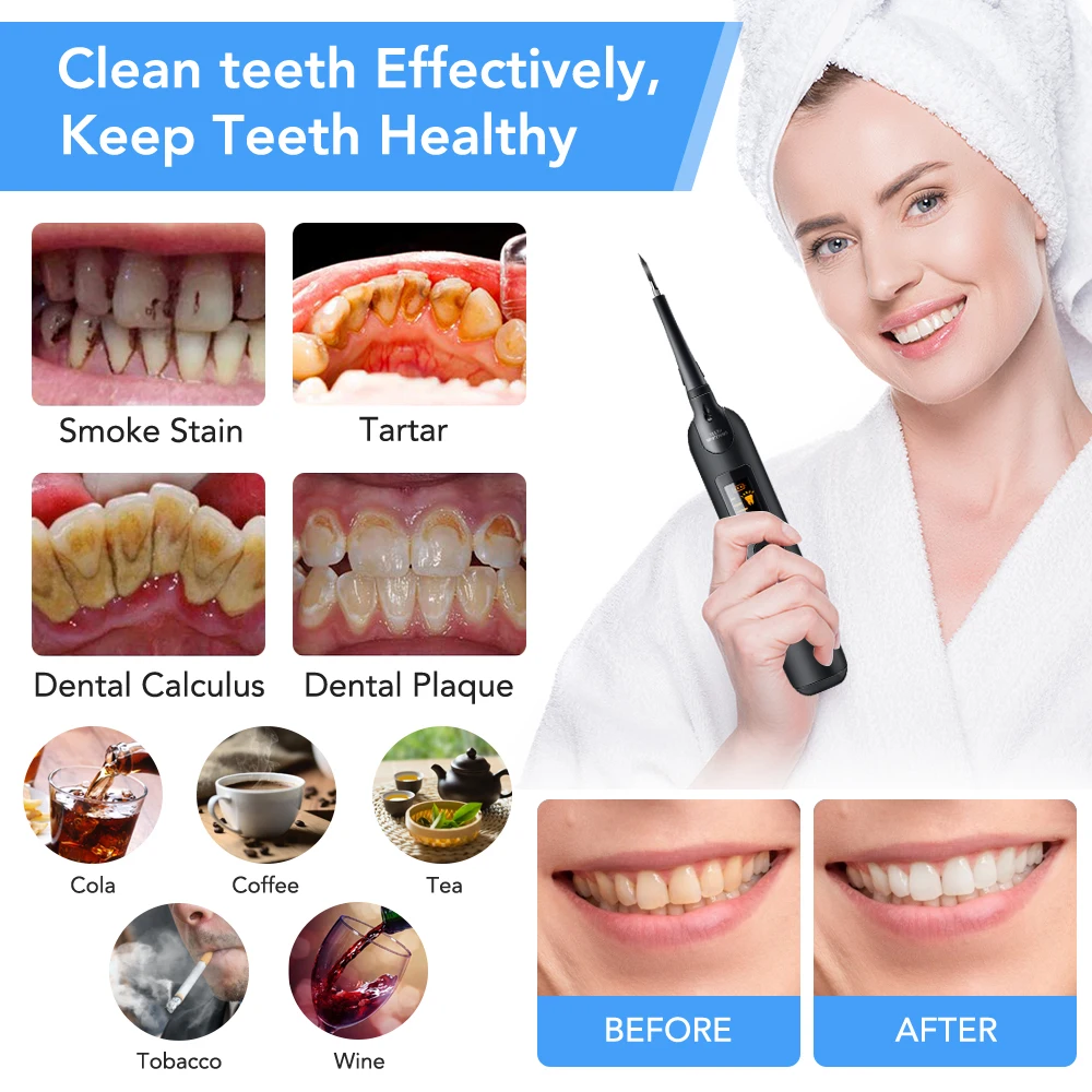 Electric Dental Scaler Toothbr - Teeth Whitening Or Tooth Whitening ulasan dan harga