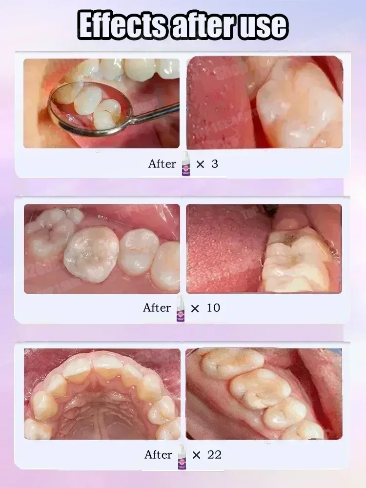 Hot sales Best-selling, Scient - Teeth Whitening Treatment ulasan dan harga