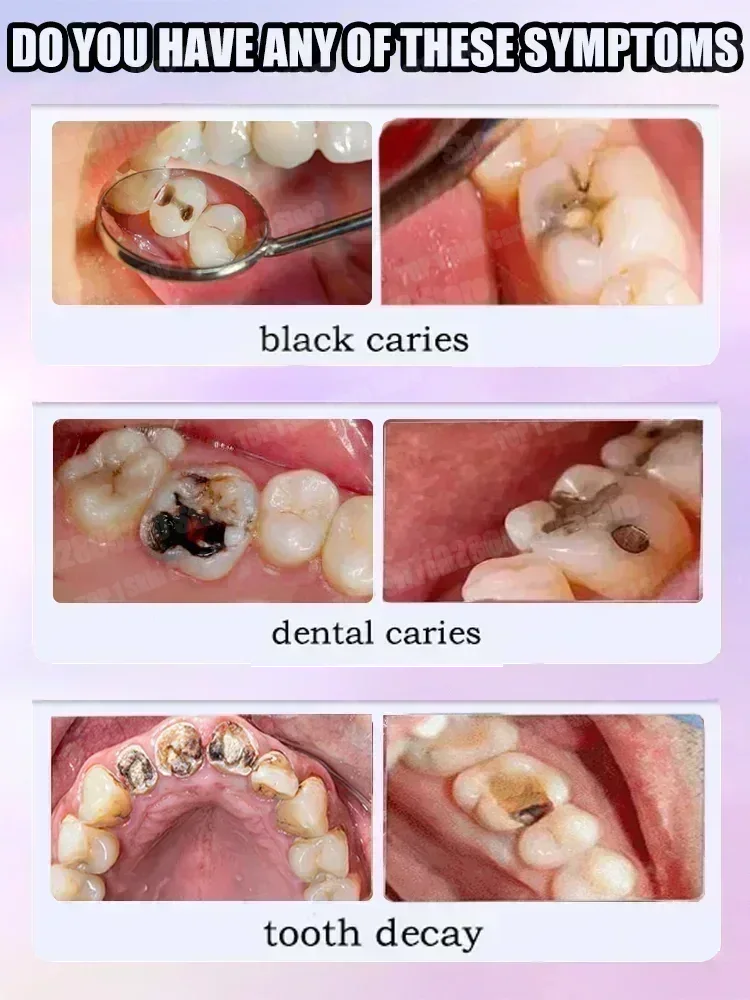 Hot sales Best-selling, Scient - Teeth Whitening Treatment ulasan dan harga