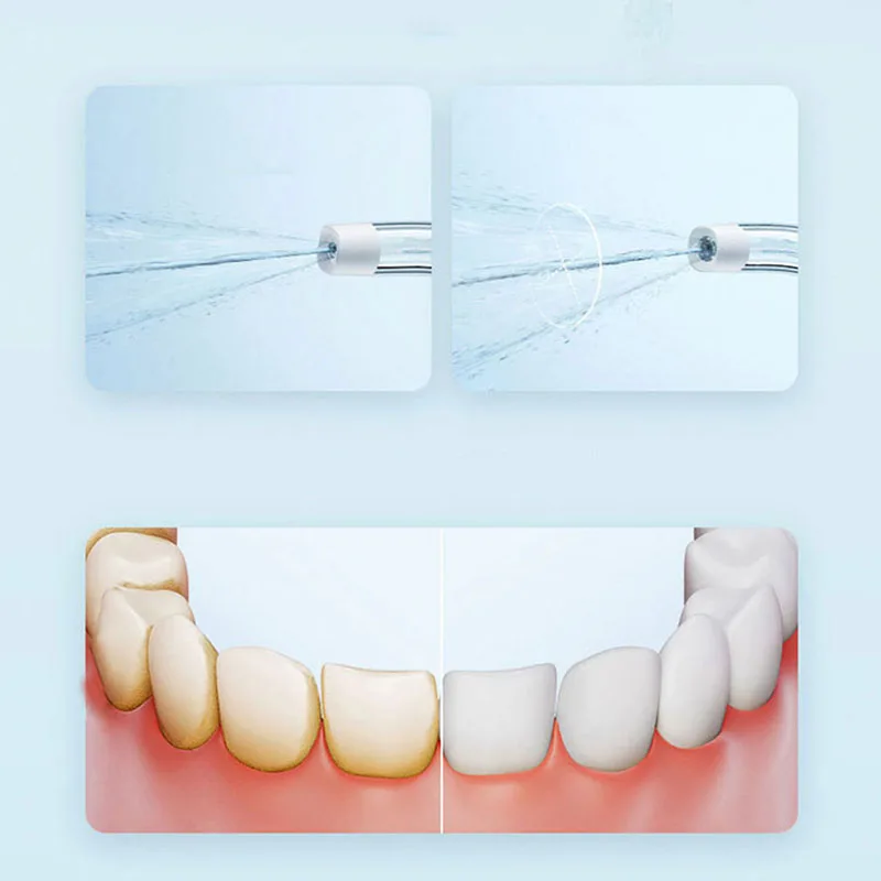 Xiaomi Portable Oral Irrigator - Teeth Whitening Or Tooth Whitening ulasan dan harga