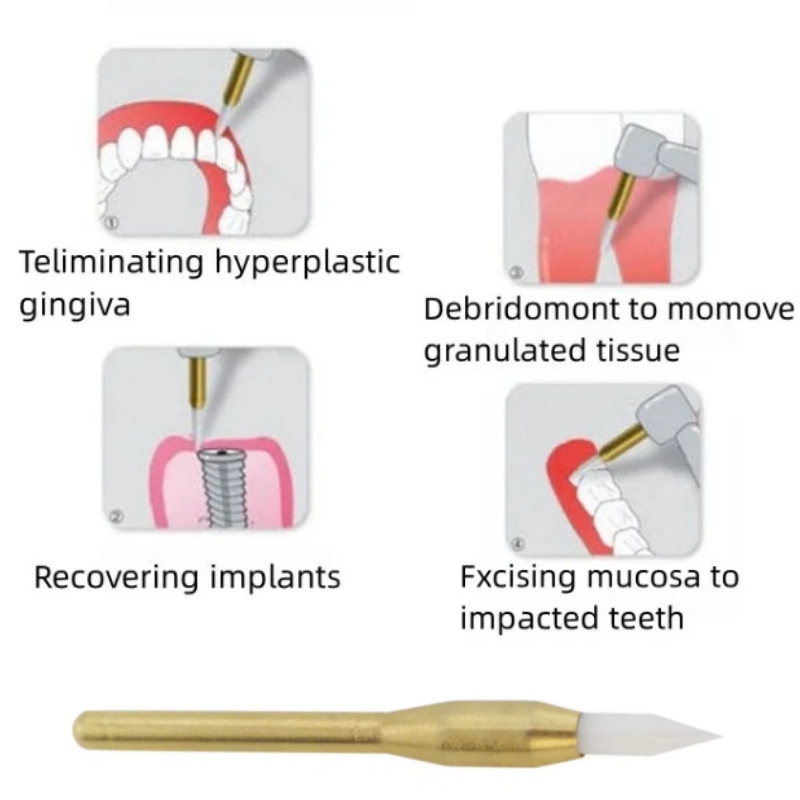 Dental Soft Trimmer Burs Surgi - Teeth Whitening Shade Guide ulasan dan harga