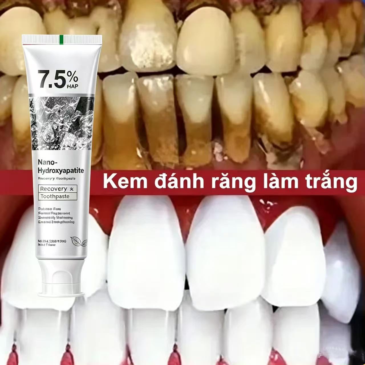 7.5% Hydroxyapatite Probiotic  - Teeth Whitening Treatment ulasan dan harga