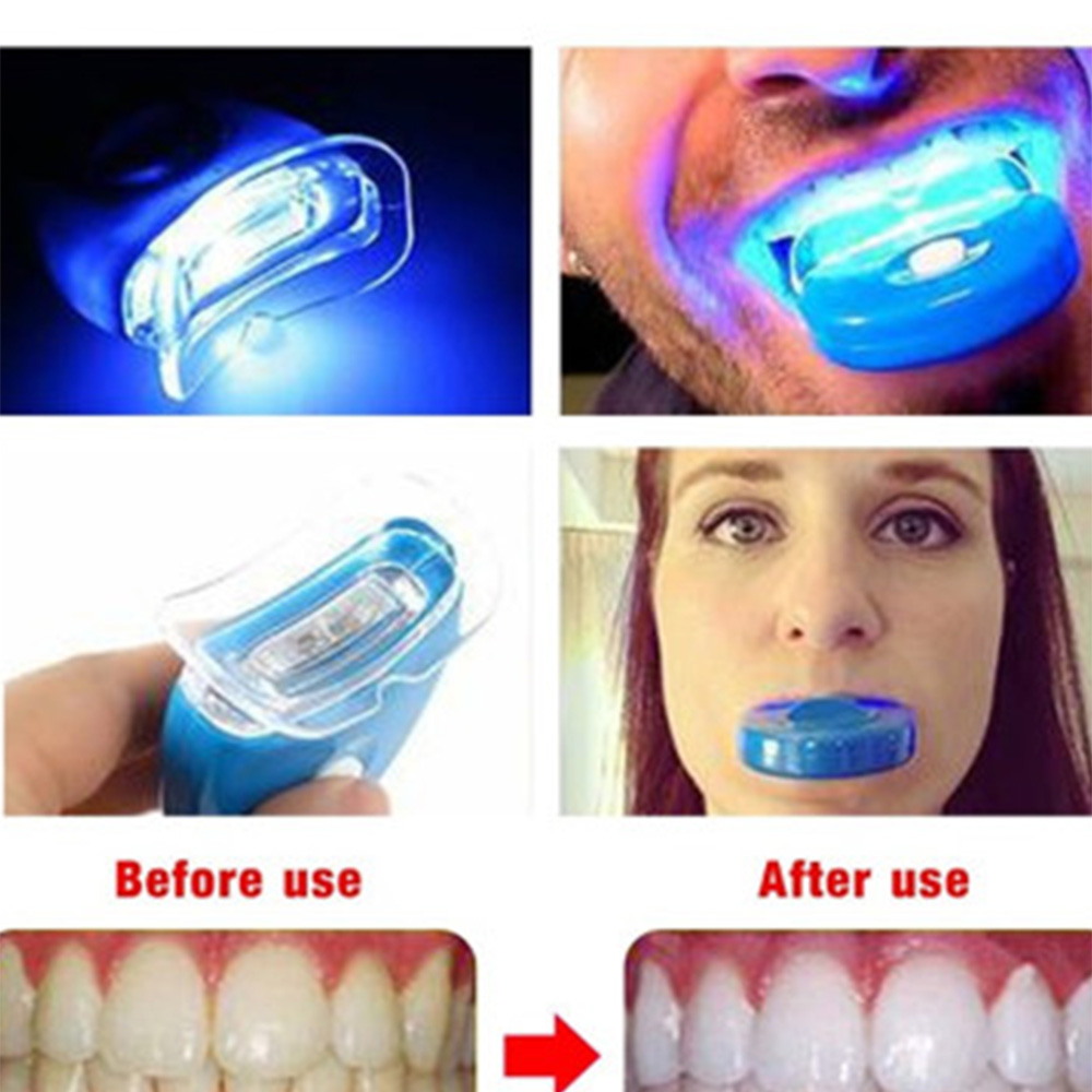 New Blue Led Teeth Whitening A - Teeth Whitening Laser ulasan dan harga