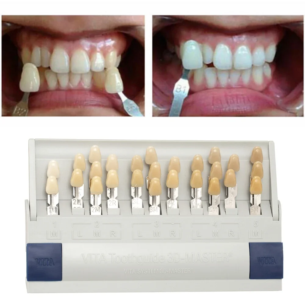 Vita 3D Master Dental Lab Blea - Teeth Whitening Shade Guide ulasan dan harga