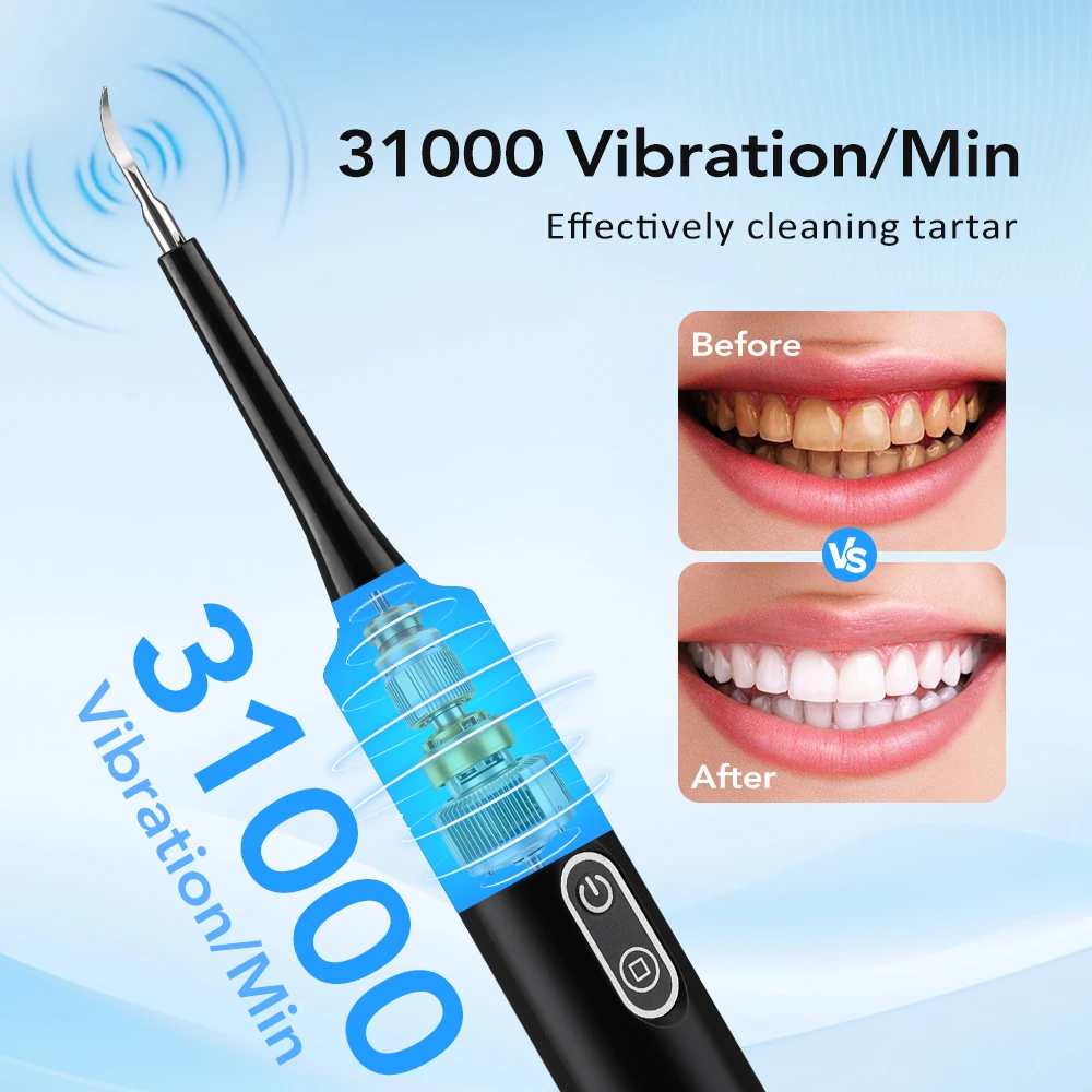 Electric Sonic Vibration Denta - Teeth Whitening Uk ulasan dan harga